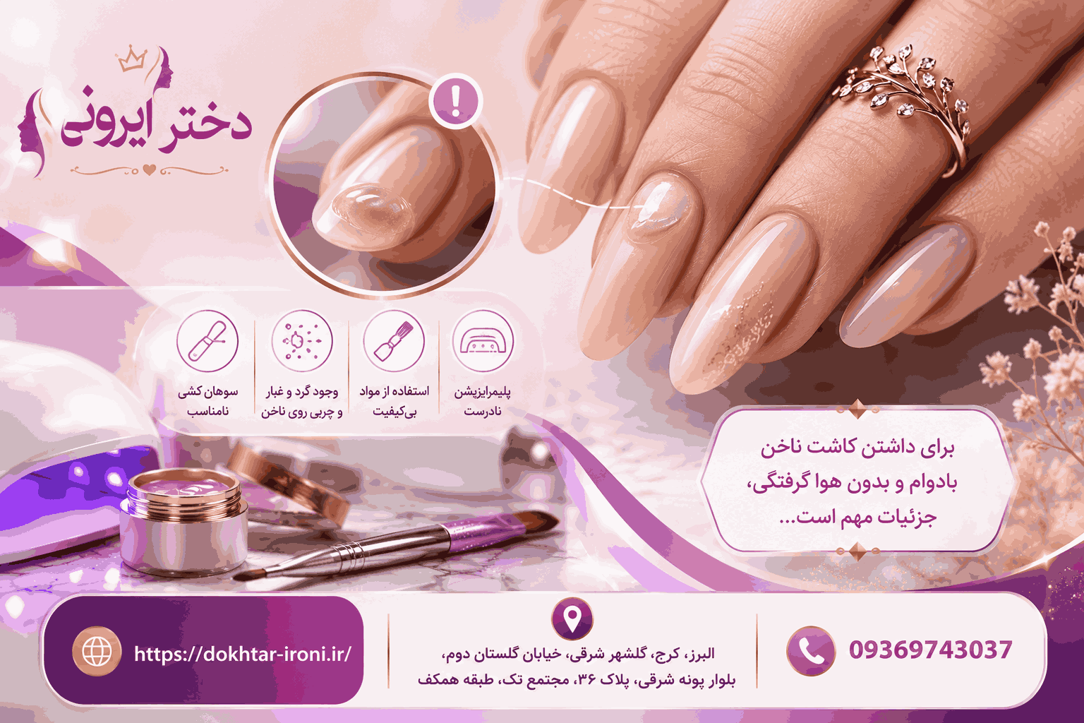 هوا گرفتن کاشت ناخن