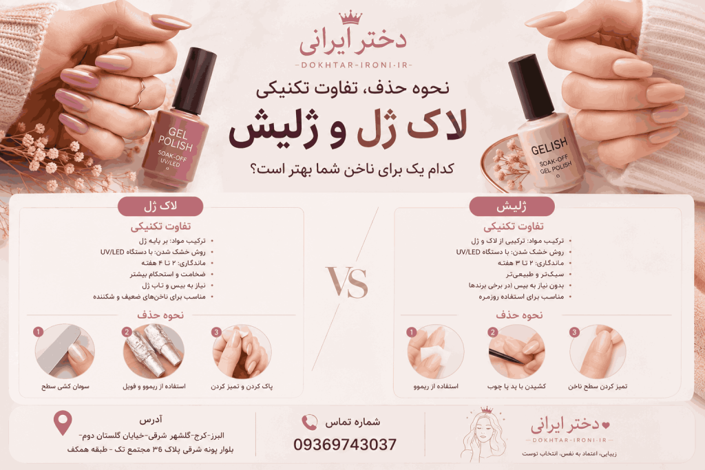 مزایا و معایب لاک ژل و ژلیش