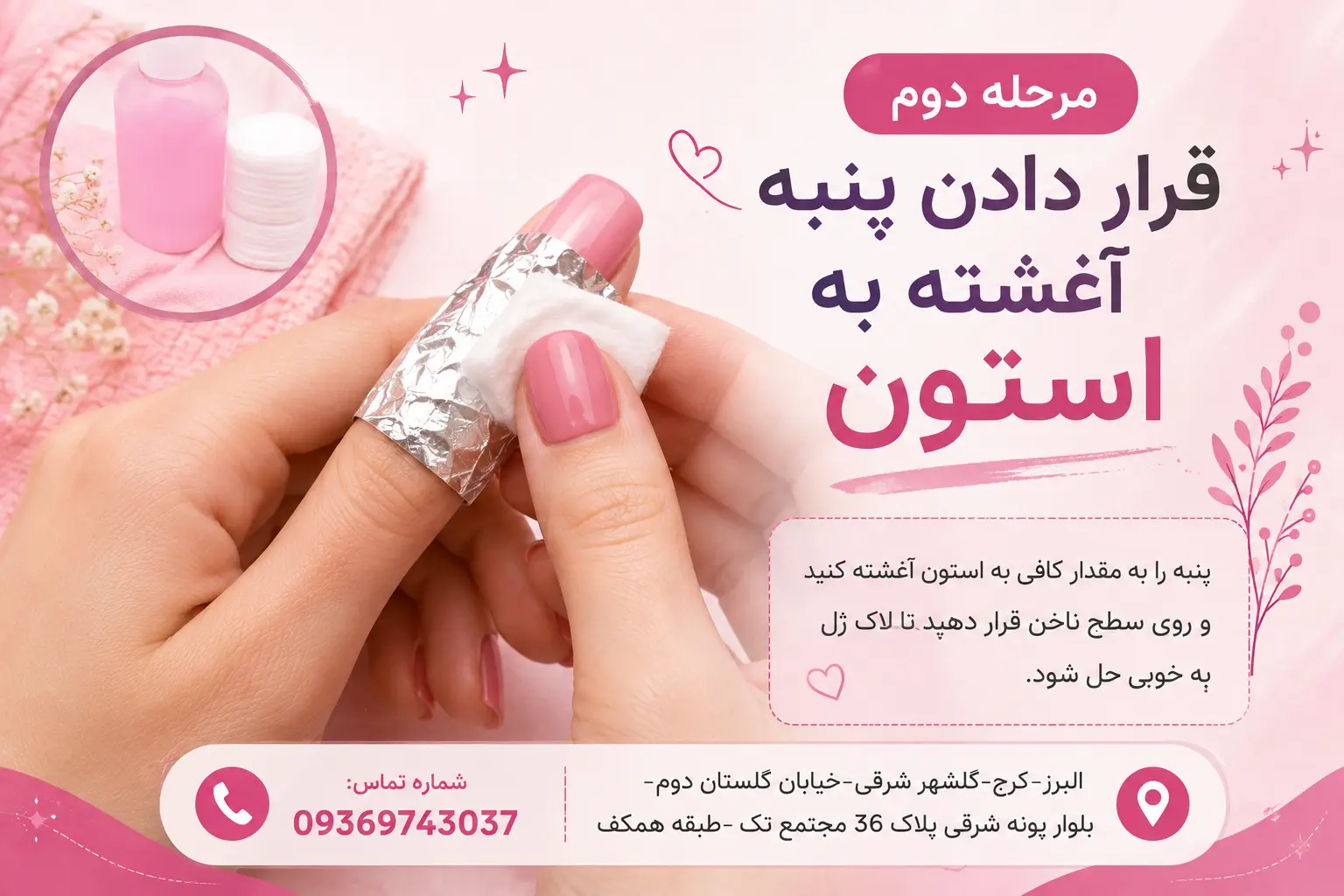 پلی ژل یا کاشت پودر ؟ مقایسه کامل ماندگاری و ظاهر نهایی