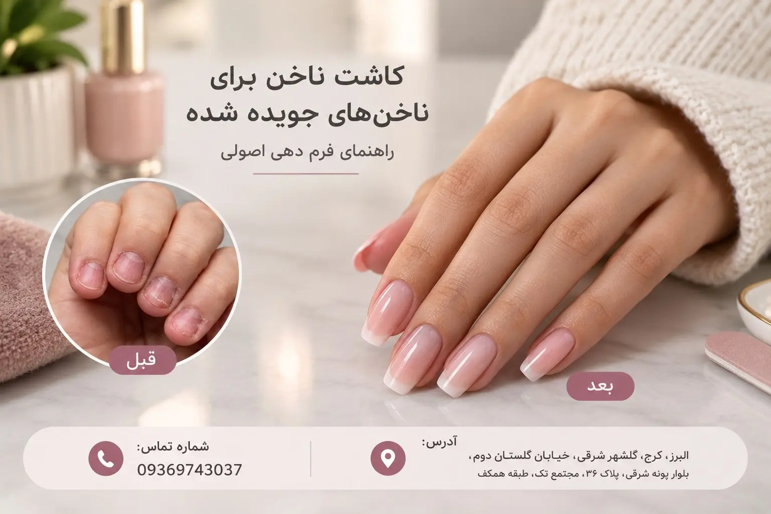 کاشت ناخن برای ناخن های جویده شده، روش های مناسب برای فرم دهی