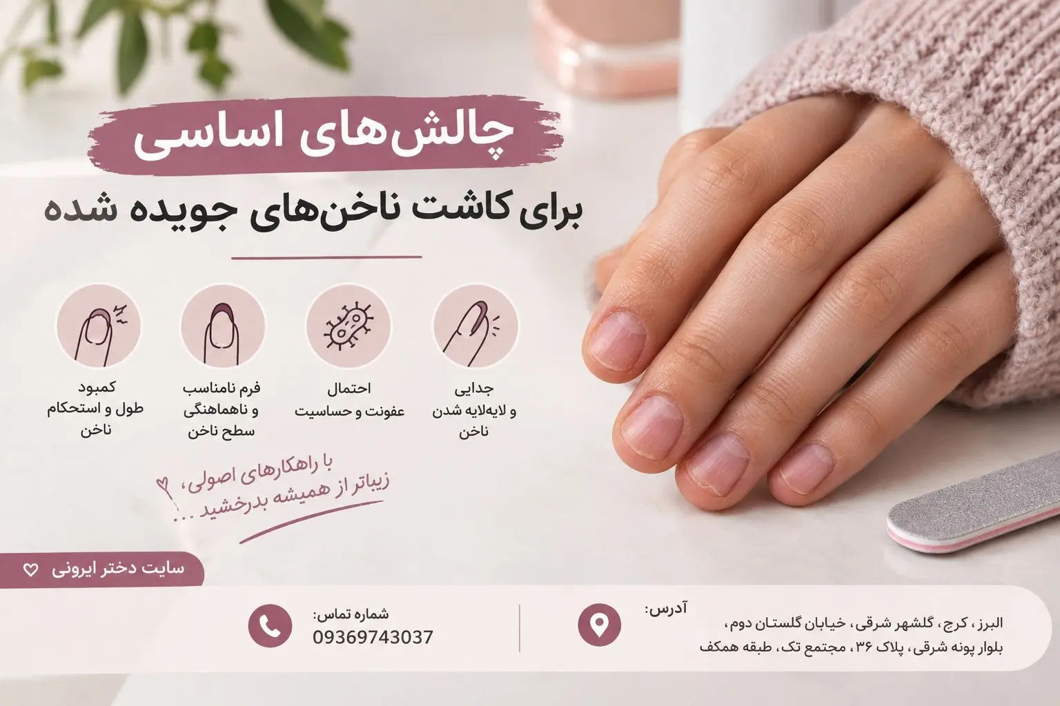 کاشت ناخن برای ناخن های جویده شده