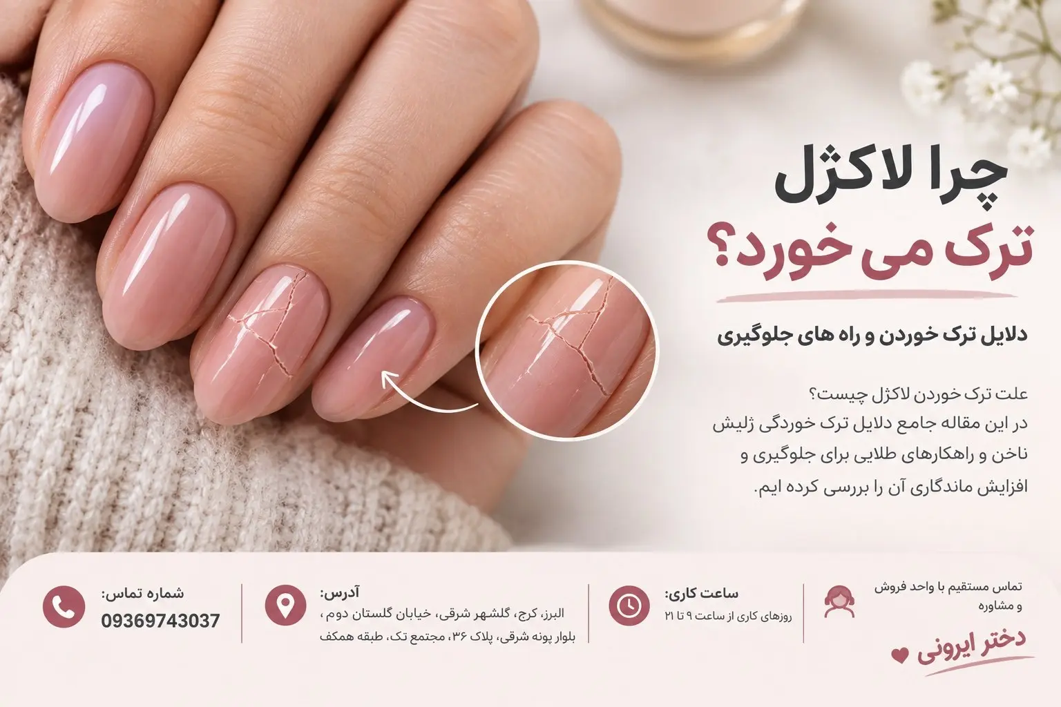 چرا لاکژل ترک می خورد؟ دلایل ترک خوردن و راه های جلوگیری