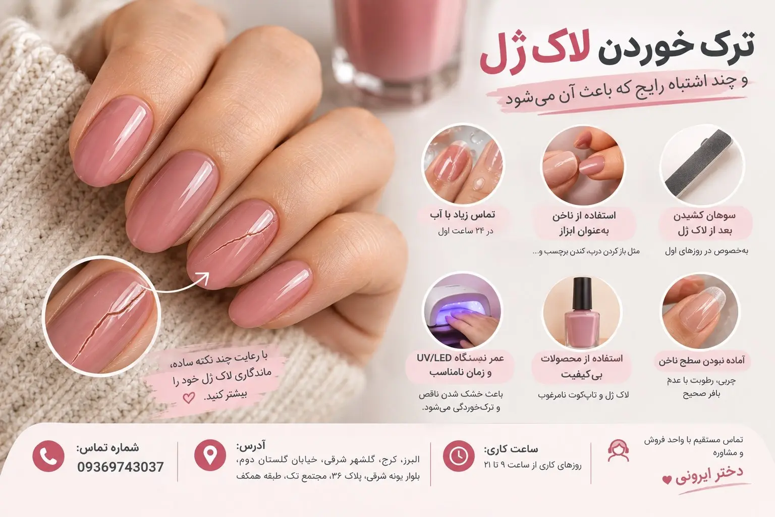 ترک خوردن لاکژل
